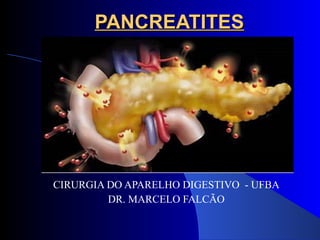 PANCREATITES CIRURGIA DO APARELHO DIGESTIVO  - UFBA DR. MARCELO FALCÃO 