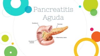 Pancreatitis
Aguda
 