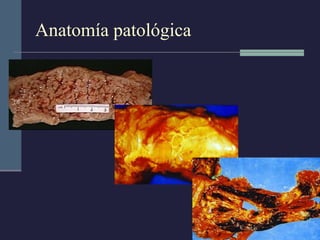 Anatomía patológica 