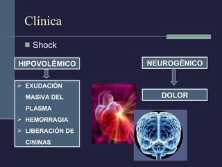 Clínica Shock EXUDACIÓN MASIVA DEL  PLASMA  HEMORRAGIA LIBERACIÓN DE  CININAS HIPOVOLÉMICO NEUROGÉNICO DOLOR 
