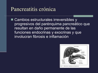 Pancreatitis crónica Cambios estructurales irreversibles y progresivos del parénquima pancreático que resultan en daño permanente de las funciones endocrinas y exocrinas y que involucran fibrosis e inflamación 