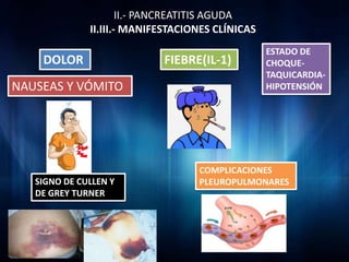 II.- PANCREATITIS AGUDA
              II.III.- MANIFESTACIONES CLÍNICAS
                                                  ESTADO DE
    DOLOR                   FIEBRE(IL-1)          CHOQUE-
                                                  TAQUICARDIA-
NAUSEAS Y VÓMITO                                  HIPOTENSIÓN




                                   COMPLICACIONES
   SIGNO DE CULLEN Y               PLEUROPULMONARES
   DE GREY TURNER
 