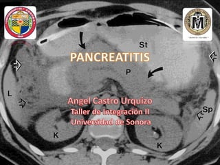 Pancreatitis (historia natural de la enfermedad)