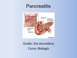 Pancreatitis




Grado: 3ro secundaria
   Curso: Biología
 