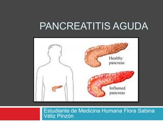 PANCREATITIS AGUDA
Estudiante de Medicina Humana Flora Sabina
Véliz Pinzón
 