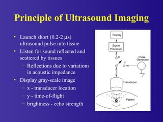 Principle of Ultrasound Imaging
• Launch short (0.2-2 µs)
ultrasound pulse into tissue
• Listen for sound reflected and
sc...