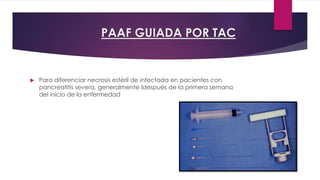 PAAF GUIADA POR TAC 
 Para diferenciar necrosis estéril de infectada en pacientes con 
pancreatitis severa, generalmente ldespués de la primera semana 
del inicio de la enfermedad 
 