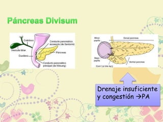 Drenaje insuficiente 
y congestión PA 
 