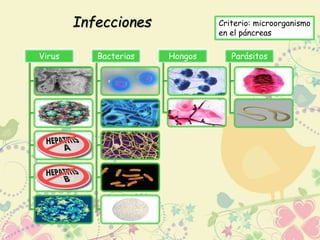 Infecciones 
Criterio: microorganismo 
en el páncreas 
Virus Bacterias Hongos Parásitos 
 