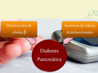 Diabetes 
Pancreática 
Disminución de 
células β 
Aumento de células 
α disfuncionales 
 