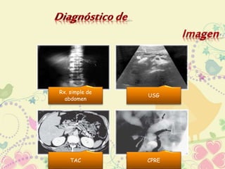 Rx. simple de 
abdomen 
USG 
TAC CPRE 
 