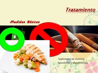 Suplementos de vitaminas 
liposolubles y oligoelementos 
 