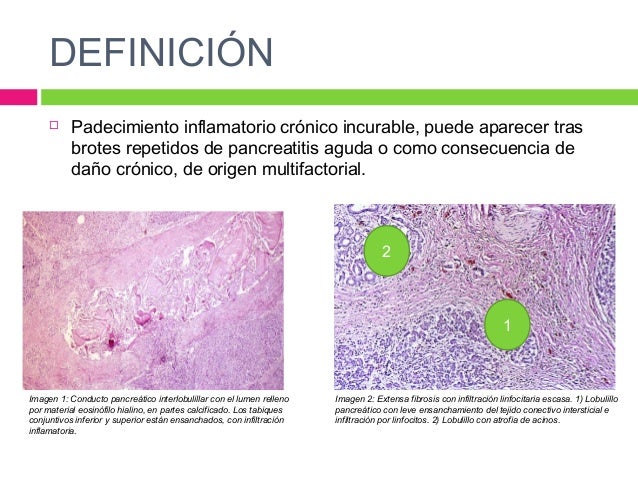INFILTRACION MEDICINA PDF DOWNLOAD INFILTRACION MEDICINA PDF DOWNLOAD
