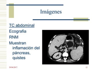 Imágenes
TC abdominal
Ecografia
RNM
Muestran
inflamación del
páncreas,
quistes
28/04/2017 12
 