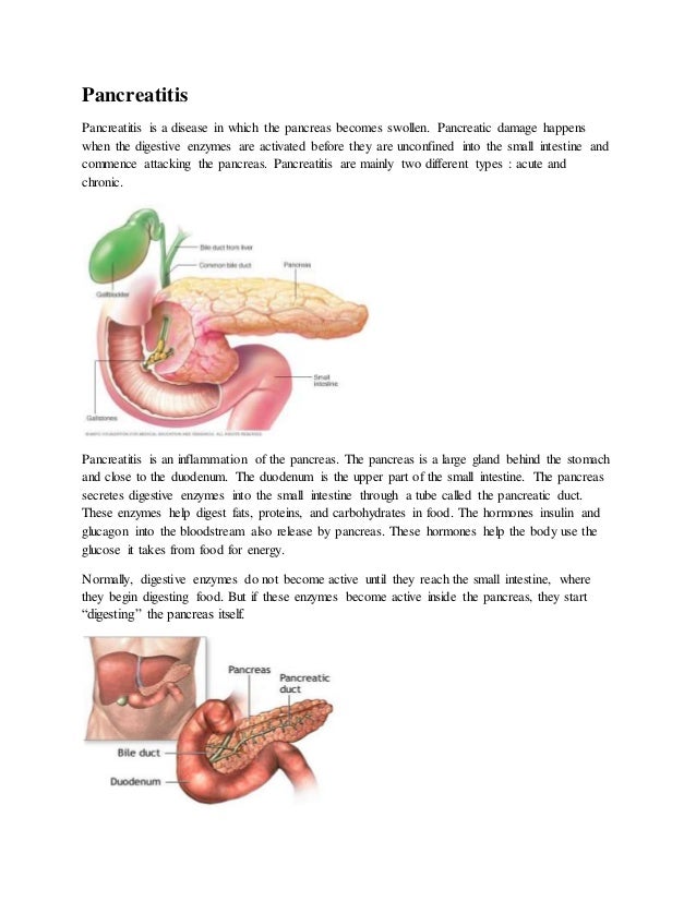 Pancreatitis Types, symptoms and diagnosis