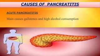 CAUSES OF PANCREATITIS
ACUTE PANCREATITIS
Main causes gallstones and high alcohol consumption
15
 
