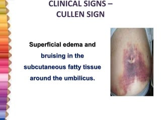 CLINICAL SIGNS –
CULLEN SIGN
Superficial edema and
bruising in the
subcutaneous fatty tissue
around the umbilicus.
 