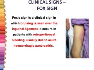 CLINICAL SIGNS –
FOX SIGN
Fox's sign is a clinical sign in
which bruising is seen over the
inguinal ligament. It occurs in
patients with retroperitoneal
bleeding, usually due to acute
haemorrhagic pancreatitis.
 