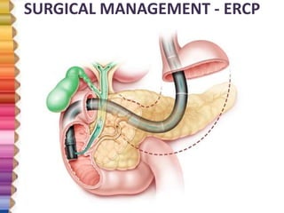 SURGICAL MANAGEMENT - ERCP
 