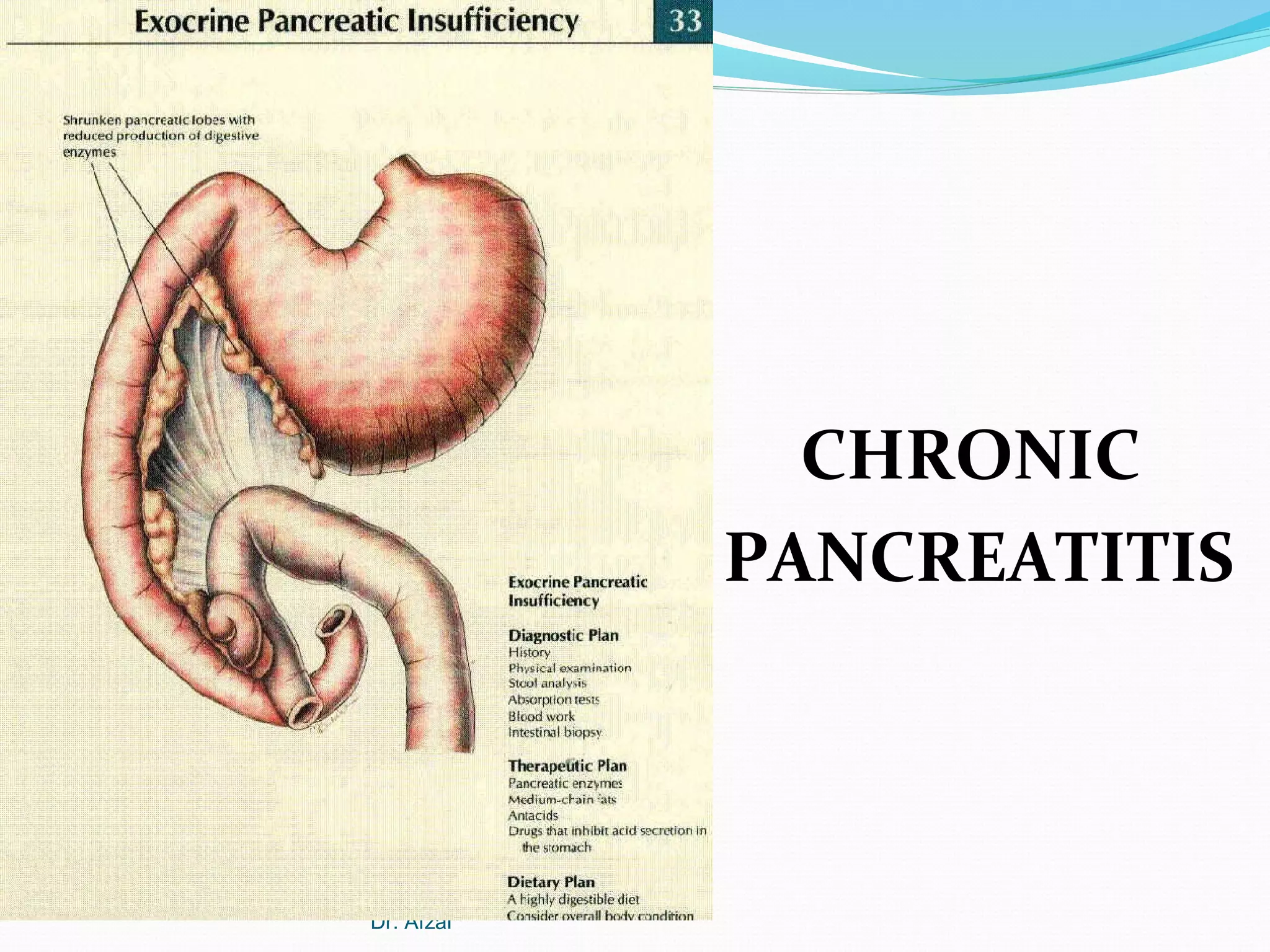 CHRONIC
PANCREATITIS

Dr. Afzal

 