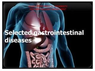 KAZAN STATE MEDICAL UNIVERSITY
PATHOPHYSIOLOGY DEPARTMENT
Selected gastrointestinal
diseases
 