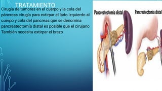 TRATAMIENTO
Cirugía de tumores en el cuerpo y la cola del
páncreas cirugía para extirpar el lado izquierdo al
cuerpo y cola del pancreas que se denomina
pancreatectomía distal es posible que el cirujano
También necesita extirpar el brazo
 