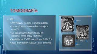 TOMOGRAFÍA
 