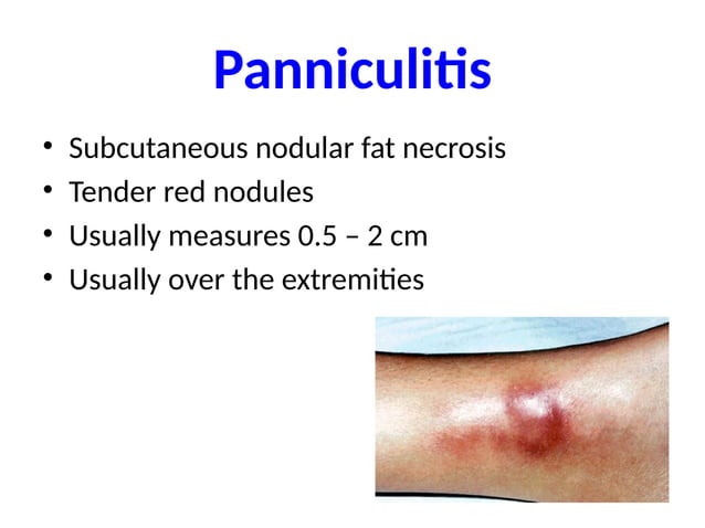 Acute pancreatis , inlamation of the pancrease | PPTX | Blood Disorders ...