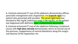 A. Contrast-enhanced CT scan of the abdomen demonstrates diffuse
pancreatic enlargement and a hypoechoic rim (capsule sign) in a
patient who presented with jaundice. The serum IgG4 level was
elevated to 942 mg/dL (reference range 4–86 mg/dL), so the patient
was diagnosed with definitive type 1 autoimmune pancreatitis.
B. Contrast-enhanced CT scan of the abdomen following a treatment
course with high-dose steroids demonstrates return to normal size of
the pancreas, reappearance of normal lobulations along the margin,
and absence of the hypoechoic rim.
 
