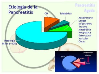 Pancreatitis Aguda Slide 4