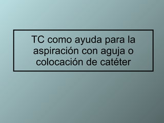 TC como ayuda para la aspiración con aguja o colocación de catéter 