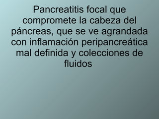 Pancreatitis focal que compromete la cabeza del páncreas, que se ve agrandada con inflamación peripancreática mal definida y colecciones de fluidos  