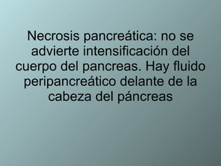Necrosis pancreática: no se advierte intensificación del cuerpo del pancreas. Hay fluido peripancreático delante de la cabeza del páncreas 