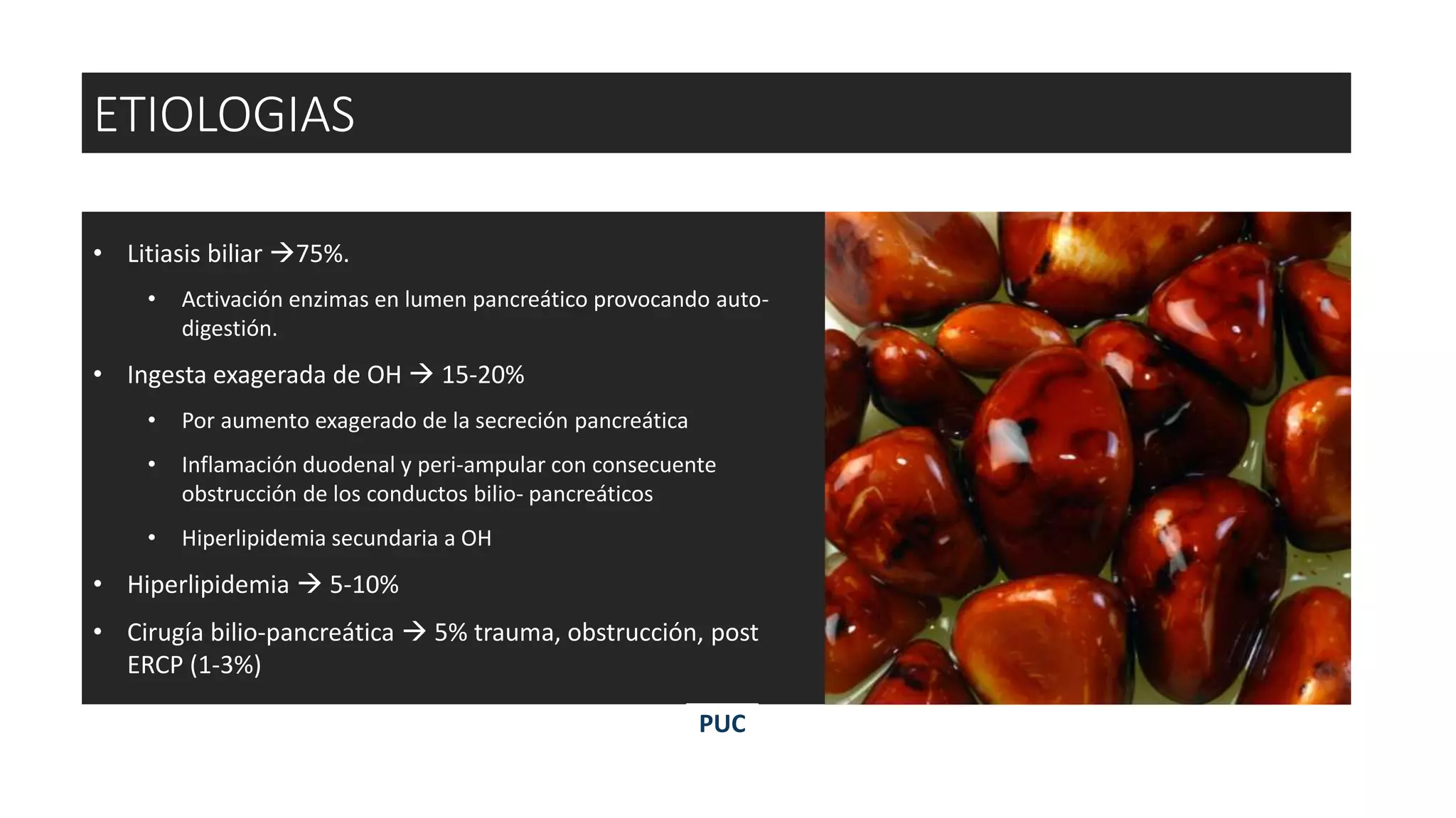 • Litiasis biliar 75%.
• Activación enzimas en lumen pancreático provocando auto-
digestión.
• Ingesta exagerada de OH  15-20%
• Por aumento exagerado de la secreción pancreática
• Inflamación duodenal y peri-ampular con consecuente
obstrucción de los conductos bilio- pancreáticos
• Hiperlipidemia secundaria a OH
• Hiperlipidemia  5-10%
• Cirugía bilio-pancreática  5% trauma, obstrucción, post
ERCP (1-3%)
ETIOLOGIAS
PUC
 