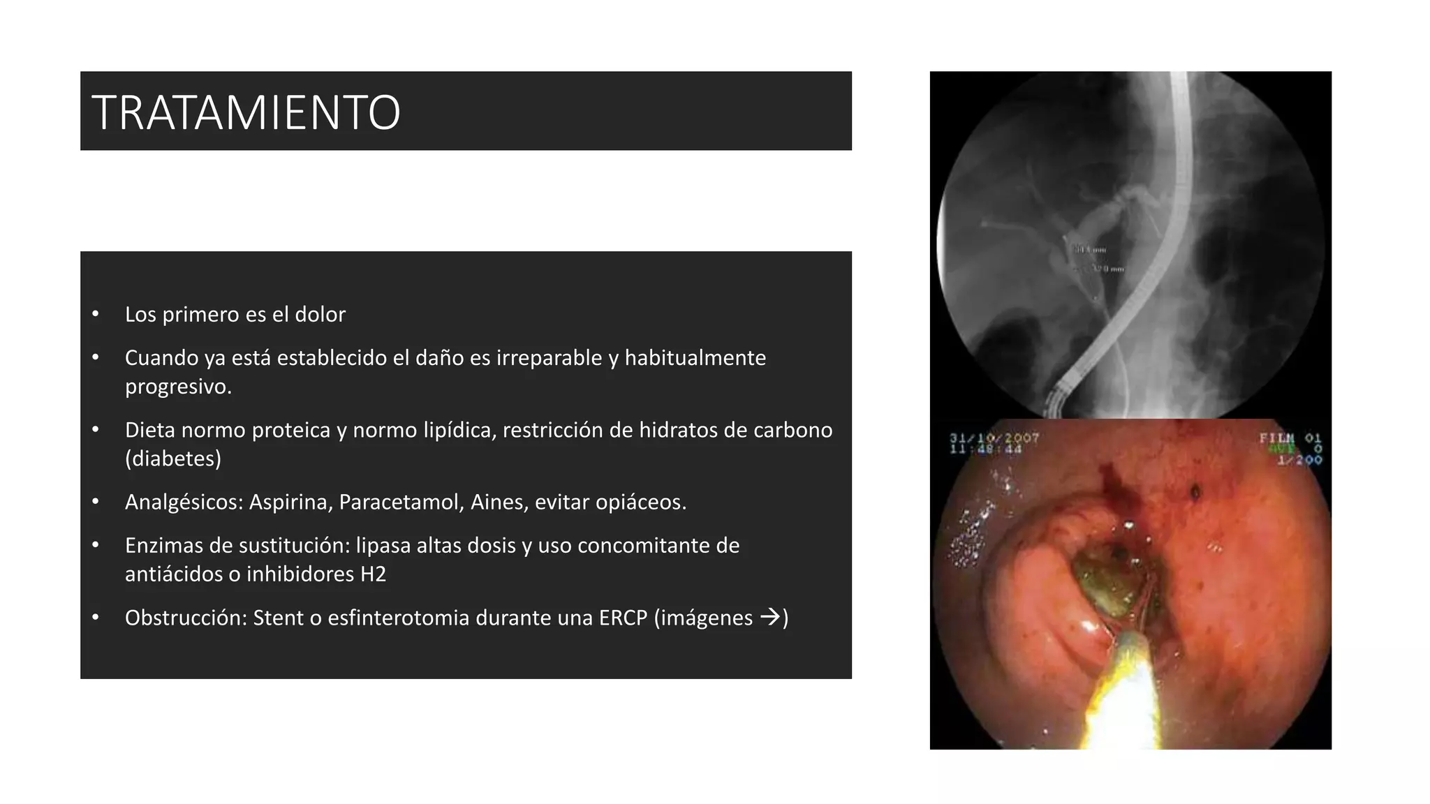 • Los primero es el dolor
• Cuando ya está establecido el daño es irreparable y habitualmente
progresivo.
• Dieta normo proteica y normo lipídica, restricción de hidratos de carbono
(diabetes)
• Analgésicos: Aspirina, Paracetamol, Aines, evitar opiáceos.
• Enzimas de sustitución: lipasa altas dosis y uso concomitante de
antiácidos o inhibidores H2
• Obstrucción: Stent o esfinterotomia durante una ERCP (imágenes )
TRATAMIENTO
 