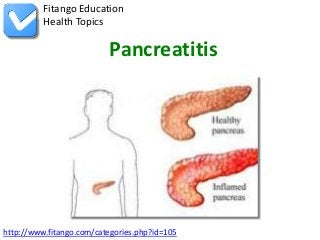 Fitango Education
          Health Topics

                          Pancreatitis




http://www.fitango.com/categories.php?id=105
 