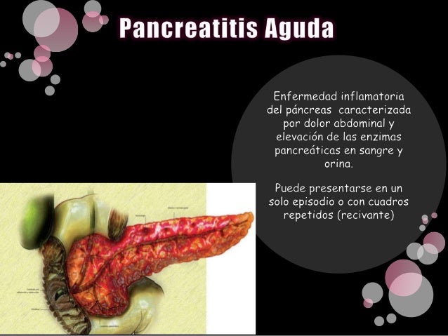 Pancreatitis Aguda y Cronica Pancreatitis Aguda y Cronica