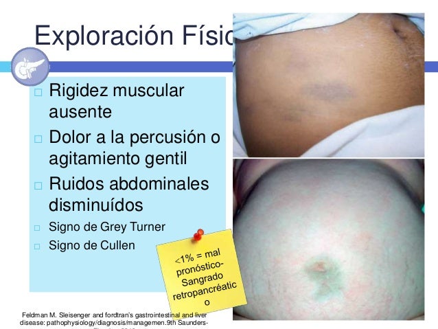 Pancreatitis Aguda