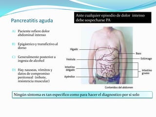 Pancreatitis aguda Paciente refiere dolor abdominal intenso  Epigástrico y transfictivo al dorsoGeneralmente posterior a ingesta de alcoholHay nauseas, vómitos y datos de compromiso peritoneal  (rebote, resistencia muscular)Ante cualquier episodio de dolor  intenso debe sospecharse PANingún síntoma es tan especifico como para hacer el diagnostico por si solo 