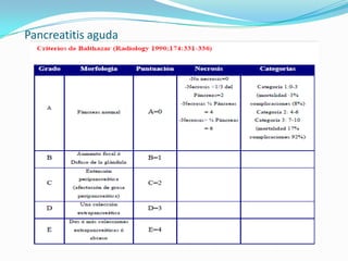 Pancreatitis aguda 