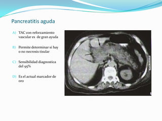 Pancreatitis aguda TAC con reforzamiento vascular es  de gran ayuda Permite determinar si hay o no necrosis tisular Sensibilidad diagnostica del 95%Es el actual marcador de oro 