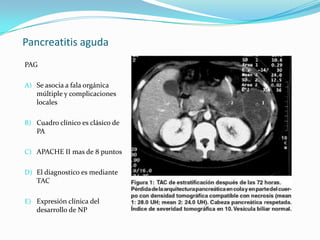 Pancreatitis aguda PAG Se asocia a fala orgánica múltiple y complicaciones locales Cuadro clínico es clásico de PAAPACHE II mas de 8 puntos El diagnostico es mediante TACExpresión clínica del desarrollo de NP 