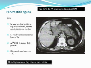 Pancreatitis aguda PAMSe asocia a desequilibrio orgánico mínimo, remite con tratamiento medicoEl cuadro clínico responde bien al TxAPACHE II menor de 8 puntosDiagnostico se hace con TAC 75 a 80% de PA se desarrolla como PAM Histológicamente hay edema intersticial 