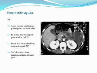 Pancreatitis aguda NP Áreas focales o difusas de parénquima sin viabilidad Se asocia a necrosis peri pancreática  (NPP) Entre mas severa la clínica : mayor riesgo de NP TAC dinámica tiene precisión diagnostica del 90% 