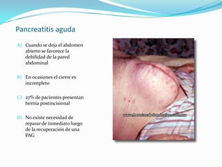 Pancreatitis aguda Cuando se deja el abdomen abierto se favorece la debilidad de la pared abdominal En ocasiones el cierre es incompleto27% de pacientes presentan hernia postincisional    No existe necesidad de reparar de inmediato luego de la recuperación de una PAG 