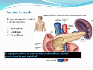 Pancreatitis aguda El jugo pancreático contiene 3 tipos de enzimas:Amilolíticas Lipolíticas Proteolíticas  El jugo pancreático no tiene actividad proteolítica, pero si precursores de esta actividad 