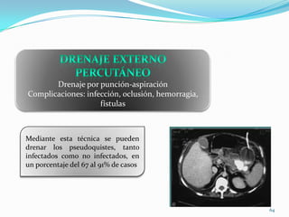 Respecto a la causa del pseudoquiste, los que tienen menor porcentaje de regresión espontánea son:TraumatismoSecundarios a una pancreatitis crónica en los que la resolución espontánea se produce sólo en un 9%.Pseudoquiste pancreático 62