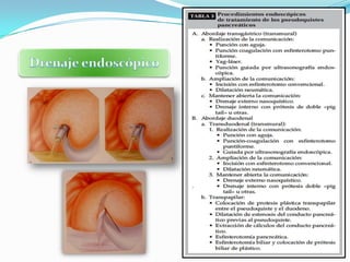 Drenaje externo percutáneoDrenaje endoscópicoDrenaje quirúrgico63TRATAMIENTOTransmuralTranspapilar 