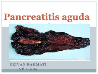 Pancreatitis aguda




 KEIVAN RAHMATI
     NP 61089
 