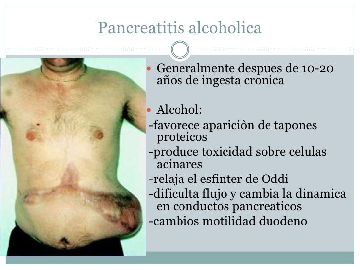 Samara la codificación del alcohol la dirección y el precio
